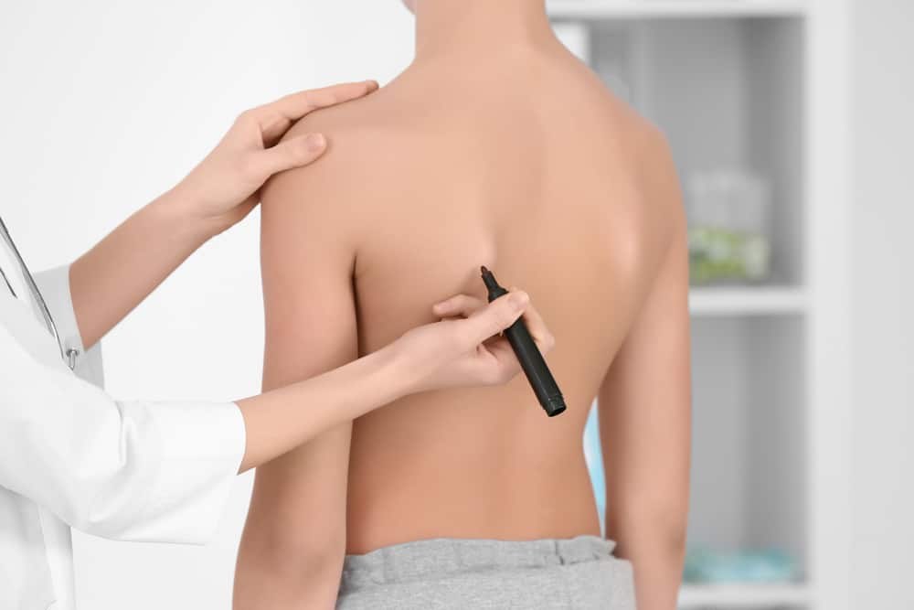 Terapia wad postawy — badanie skoliozy